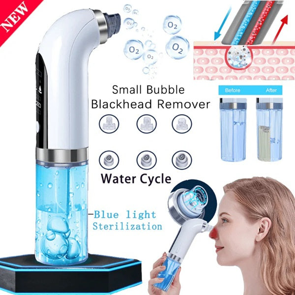 Bubble Facial & Blackhead Remover – Your Skin’s New Best Friend for a Poreless Glow