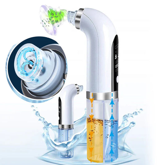 Bubble Facial & Blackhead Remover – Your Skin’s New Best Friend for a Poreless Glow