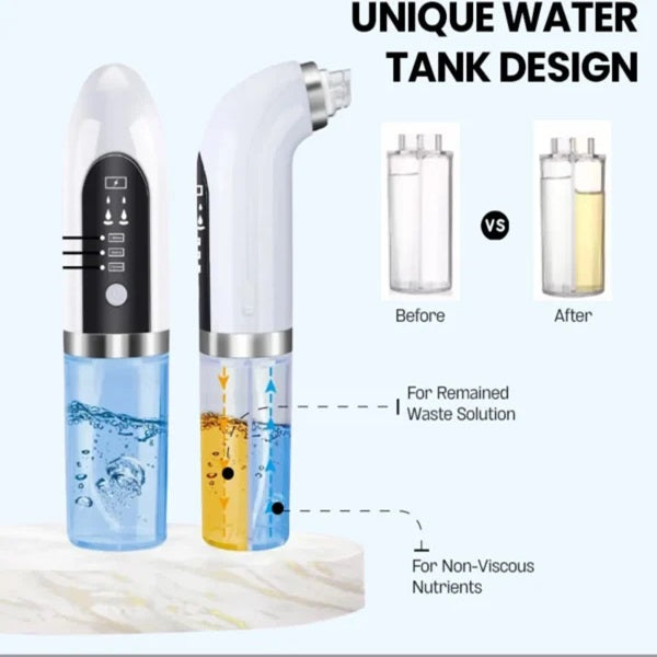 Bubble Facial & Blackhead Remover – Your Skin’s New Best Friend for a Poreless Glow