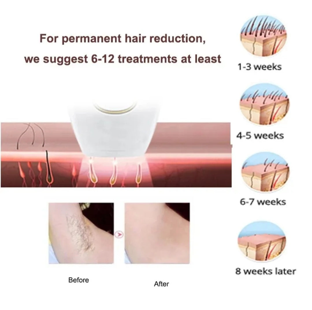Laser Hair Removal Handset